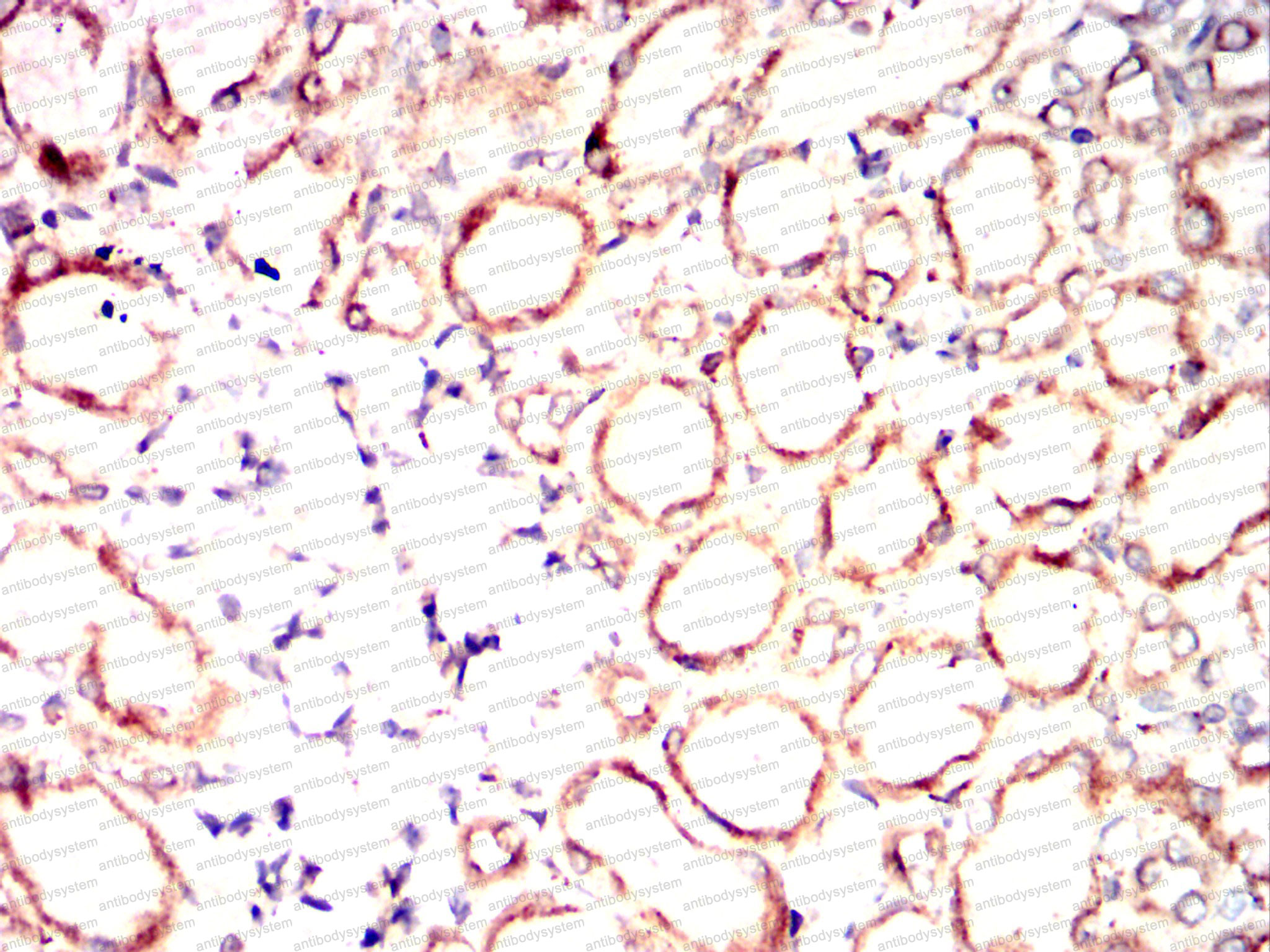 Валидация AntibodySystem RHC84902 (1115)