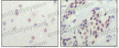 Валидация AntibodySystem RHB17601