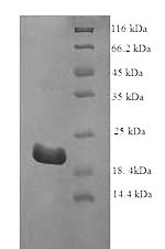 SDS-PAGE