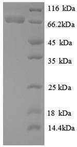 SDS-PAGE
