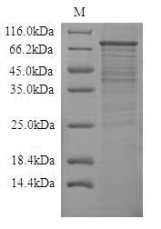 SDS-PAGE