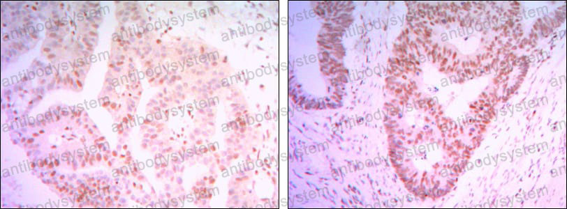 Валидация AntibodySystem RHN92101