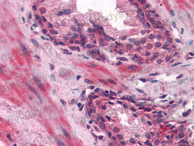 Валидация AntibodySystem RHD92601