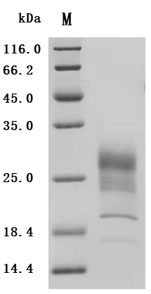 SDS-PAGE