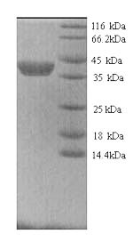 SDS-PAGE