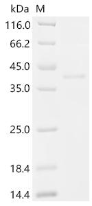 SDS-PAGE