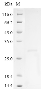 SDS-PAGE