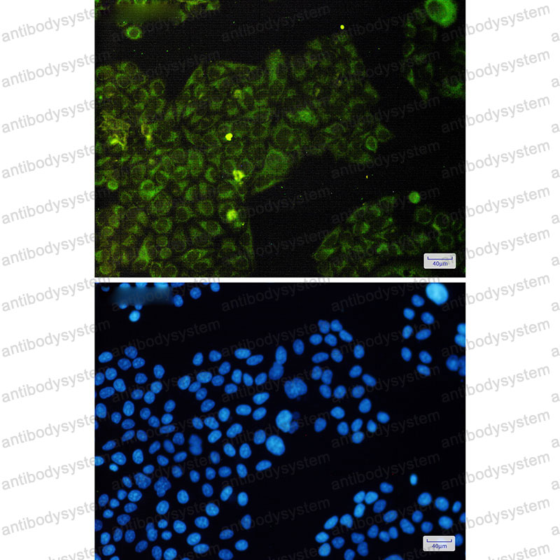 Валидация IF - AntibodySystem RHC20902