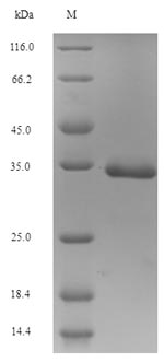 SDS-PAGE