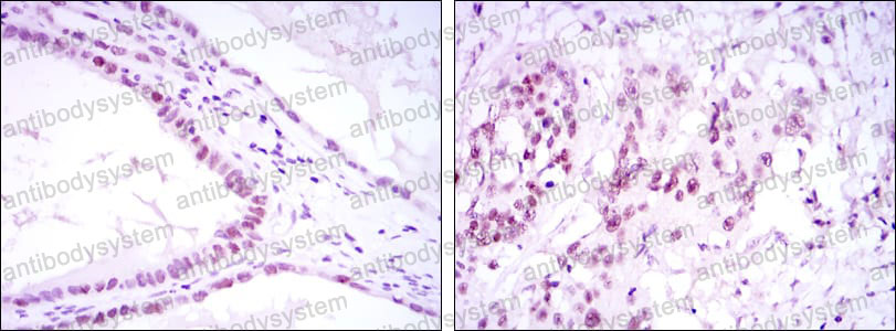 Валидация AntibodySystem RHG97902
