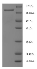 SDS-PAGE