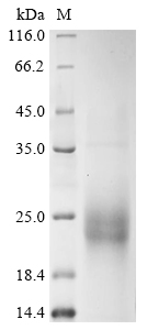 SDS-PAGE
