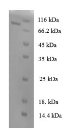 SDS-PAGE