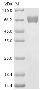 SDS-PAGE