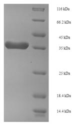 SDS-PAGE