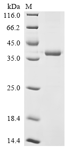SDS-PAGE