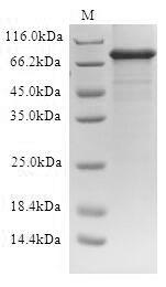 SDS-PAGE