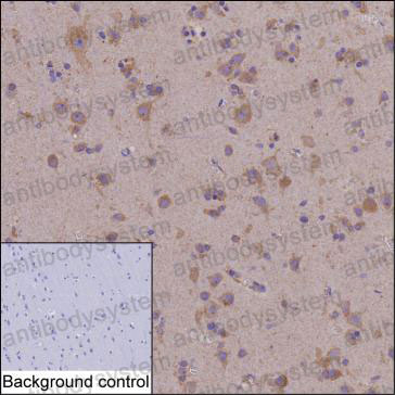 Валидация AntibodySystem RHP02601