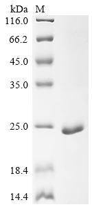 SDS-PAGE