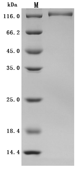 SDS-PAGE