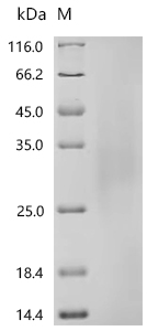 SDS-PAGE