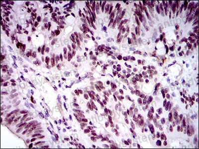 Валидация AntibodySystem RHJ56302