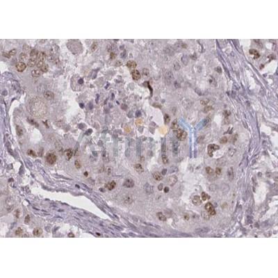 Валидация Affinity AF4112 - 2166