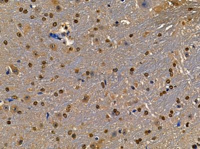 Валидация Affinity DF13956 - 9705