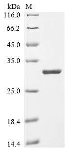 SDS-PAGE