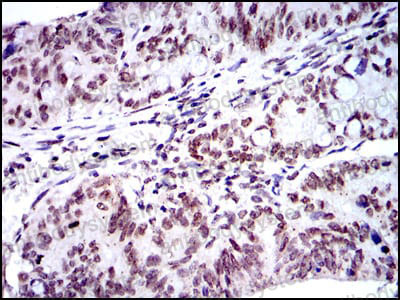 Валидация AntibodySystem RHE07802
