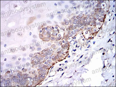 Валидация AntibodySystem RHC95705 (1211)