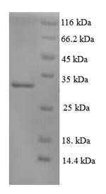 SDS-PAGE