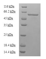 SDS-PAGE