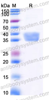 AHJ70104, SDS-PAGE