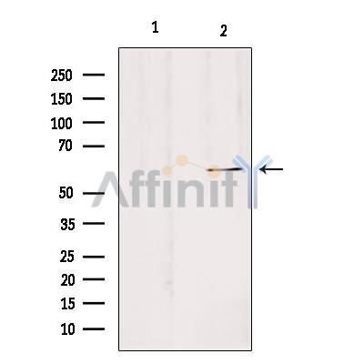 Валидация Affinity DF4524 - 16093