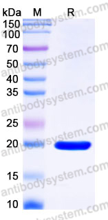 YHJ27102, SDS-PAGE