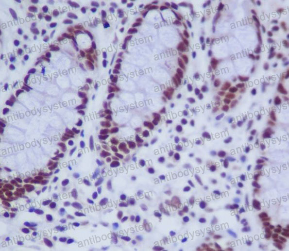 Валидация AntibodySystem RHF47602