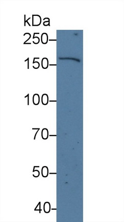 14275