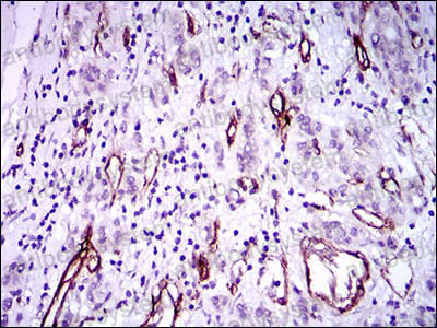 Валидация AntibodySystem RHF20002