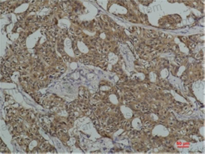 Валидация AntibodySystem RHC85603