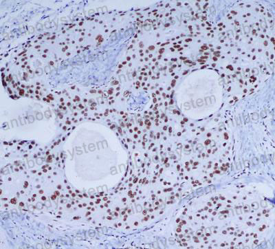 Валидация AntibodySystem RHF68703