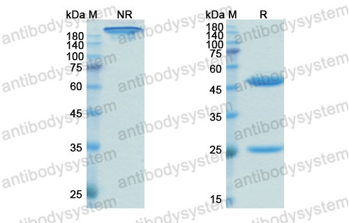 Валидация SDS-PAGE - AntibodySystem DHG01304