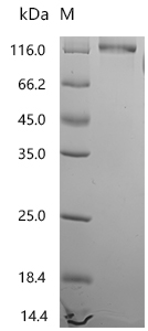 SDS-PAGE