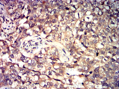 Валидация AntibodySystem RHJ56402