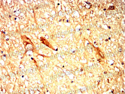 Валидация AntibodySystem RHJ44003 (3412)