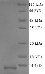 SDS-PAGE