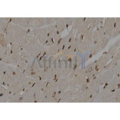 Валидация Affinity DF6231 - 17512