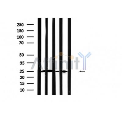 Валидация Affinity DF6264 - 17556