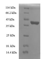 SDS-PAGE