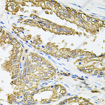 Иммуногистохимия, HLA-DQA1, ткань предстательной железы человека